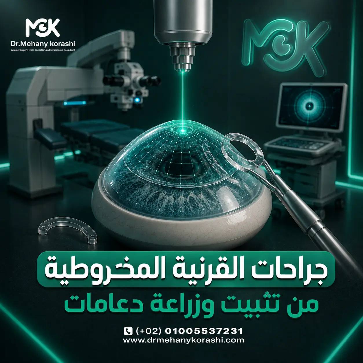 جراحات القرنية المخروطية من تثبيت وزراعة دعامات