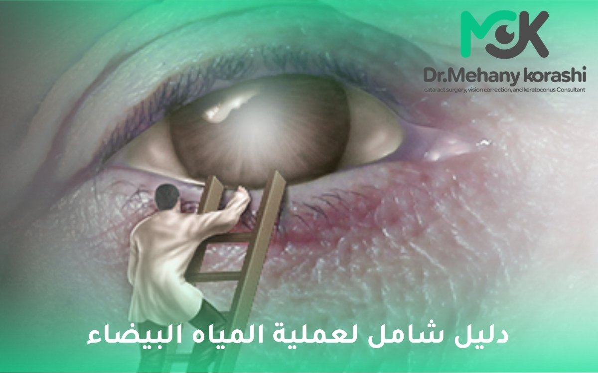 عملية المياه البيضاء