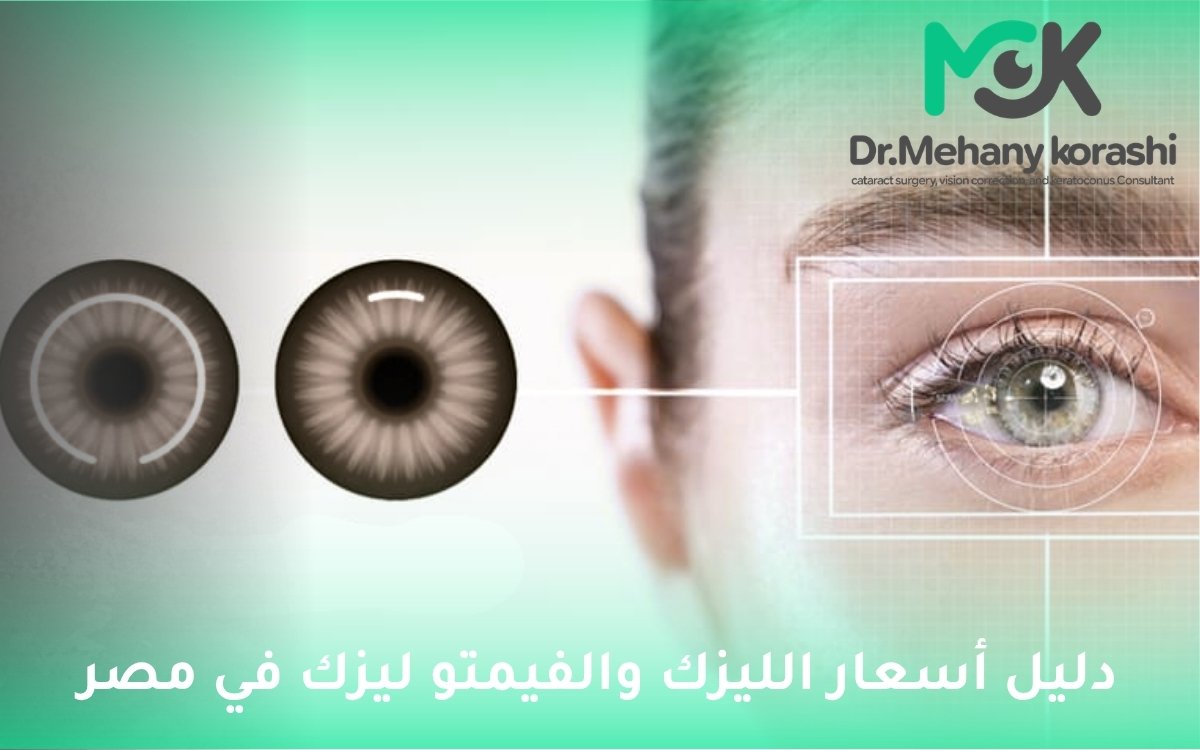 أسعار الليزك والفيمتو ليزك في مصر