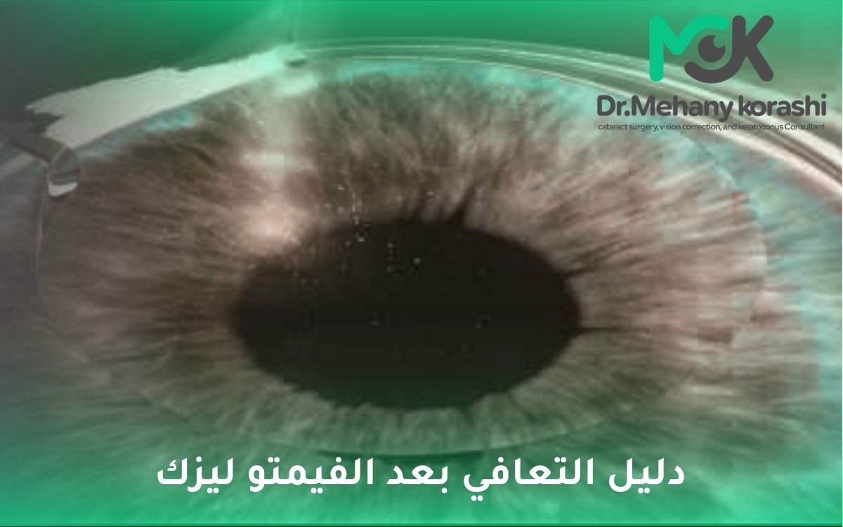 التعافي بعد الفيمتو ليزك