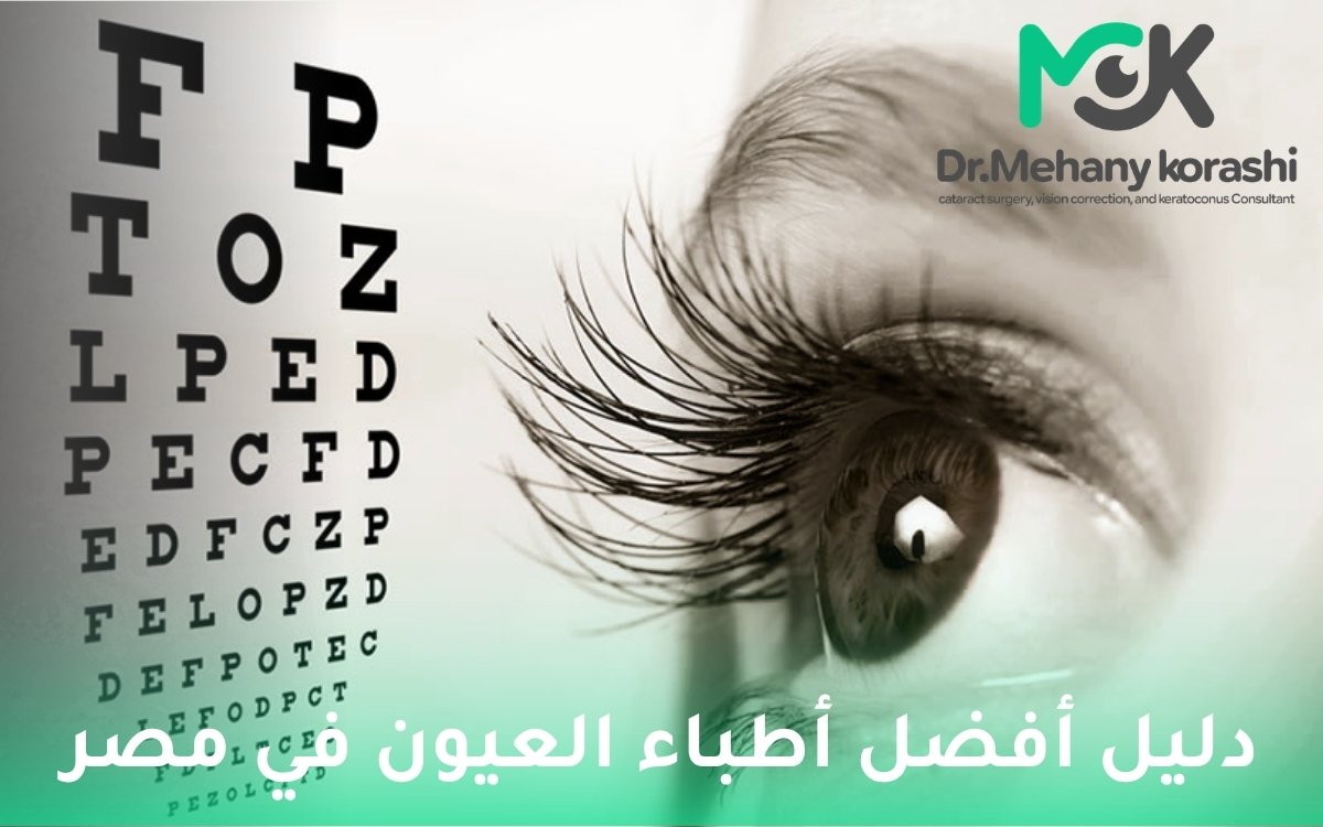 أفضل أطباء العيون في مصر