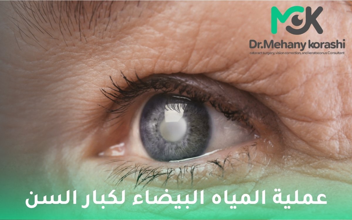 عملية المياه البيضاء لكبار السن