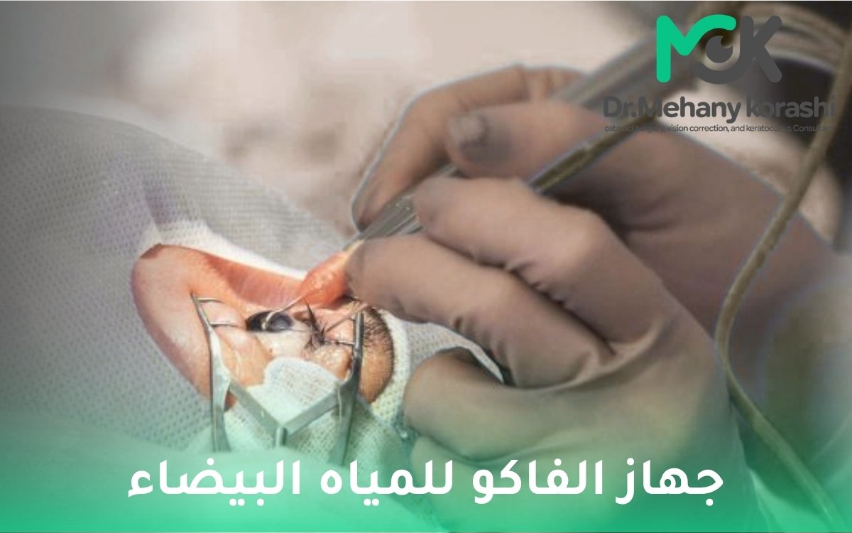 جهاز الفاكو للمياه البيضاء