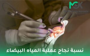 نسبة نجاح عملية المياه البيضاء
