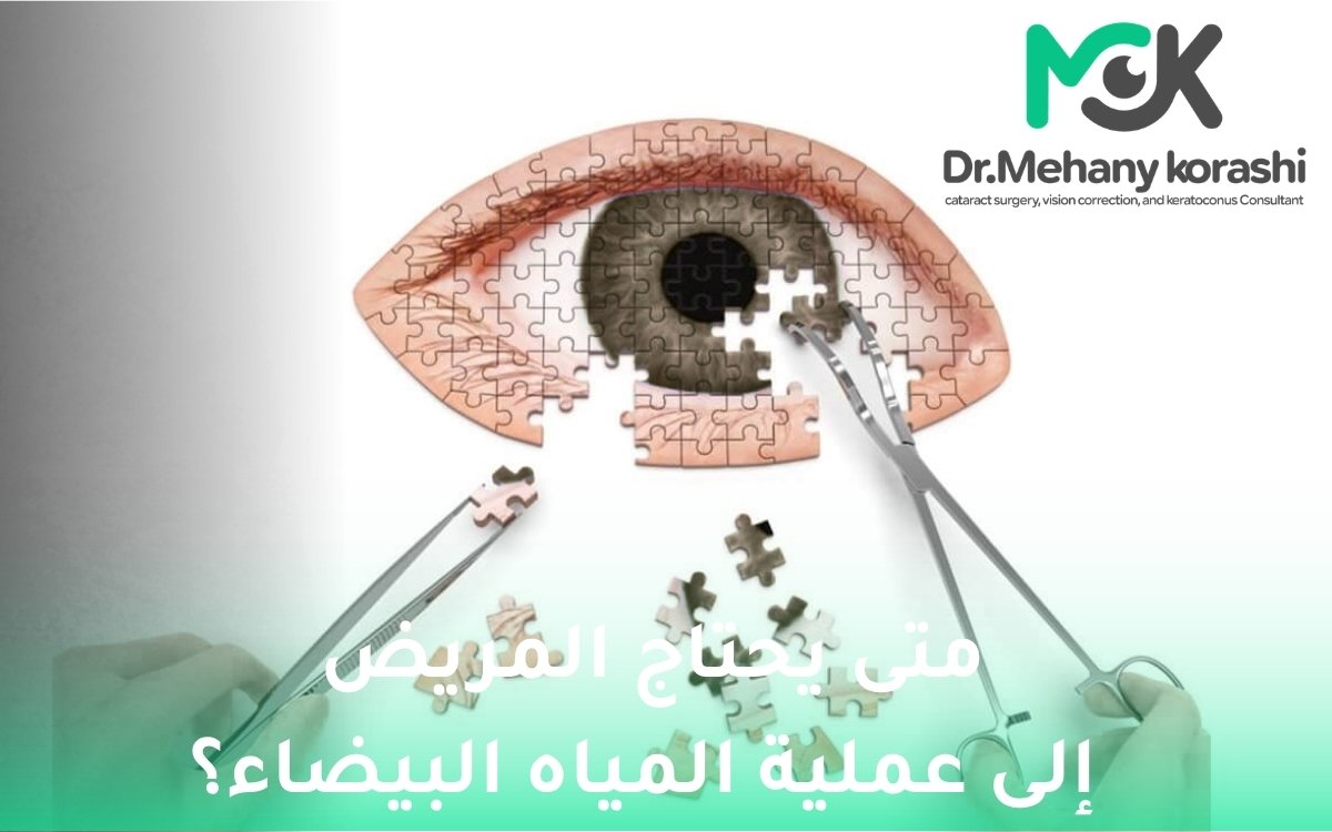 متى يحتاج المريض إلى عملية المياه البيضاء