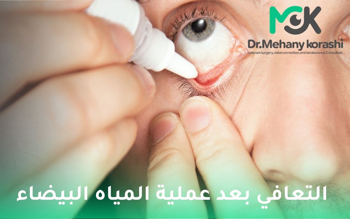 التعافي بعد عملية المياه البيضاء