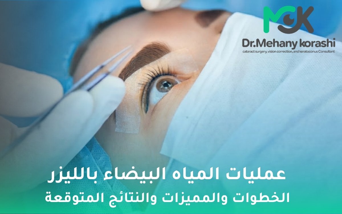 عمليات المياه البيضاء بالليزر
