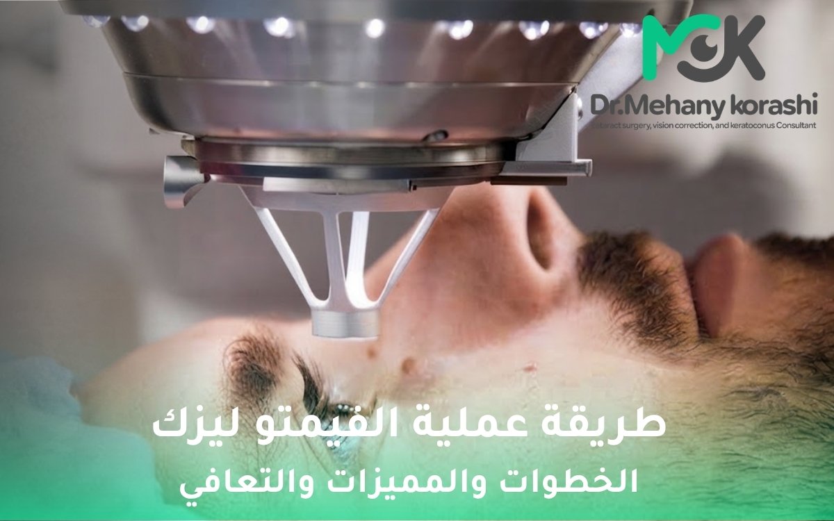 طريقة عملية الفيمتو ليزك