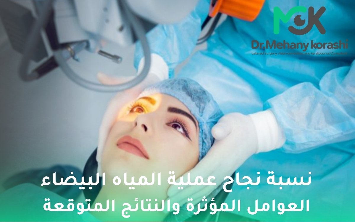 نسبة نجاح عملية المياه البيضاء