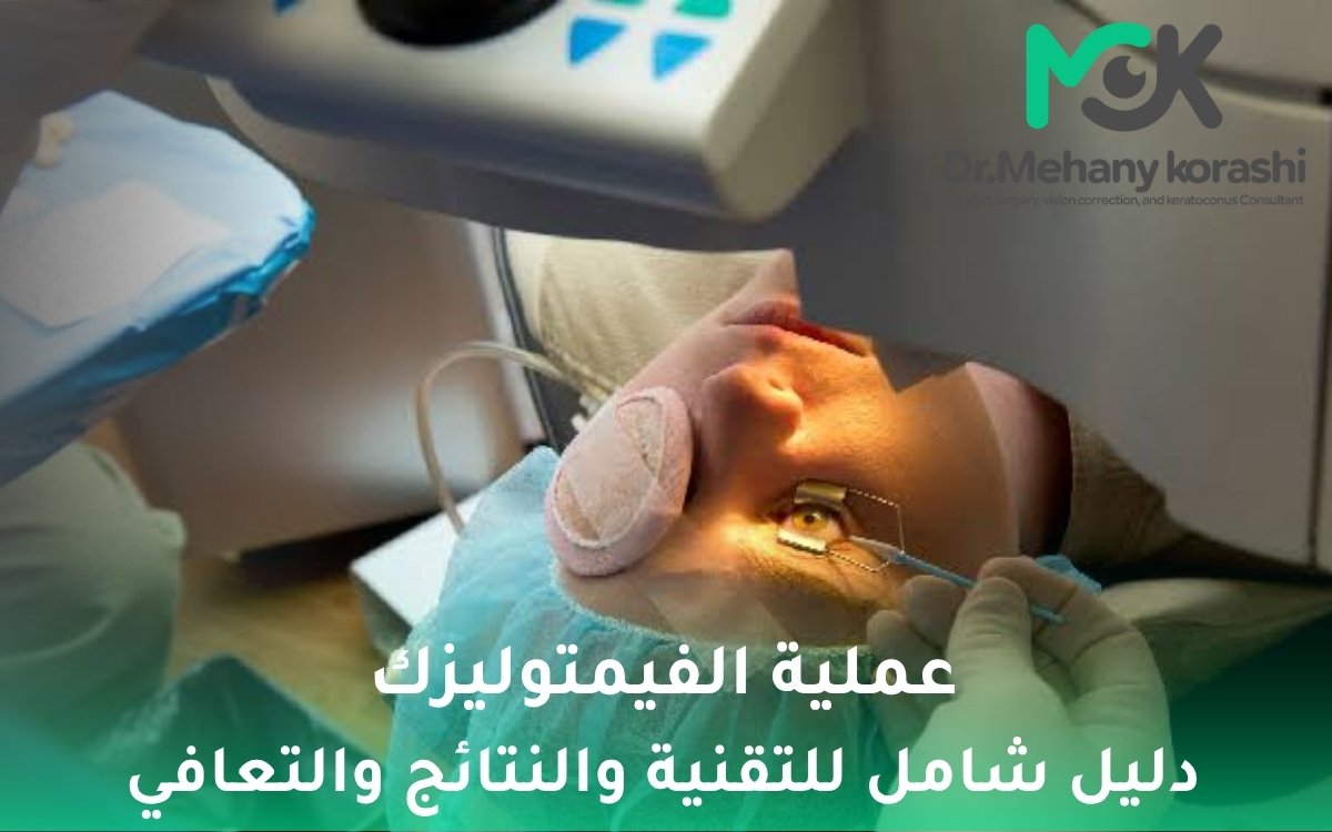 عملية الفيمتوليزك