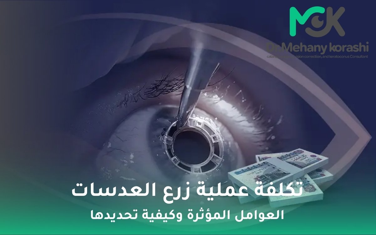 تكلفة عملية زرع العدسات
