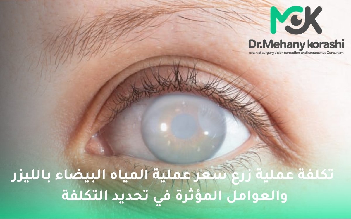 سعر عملية المياه البيضاء بالليزر