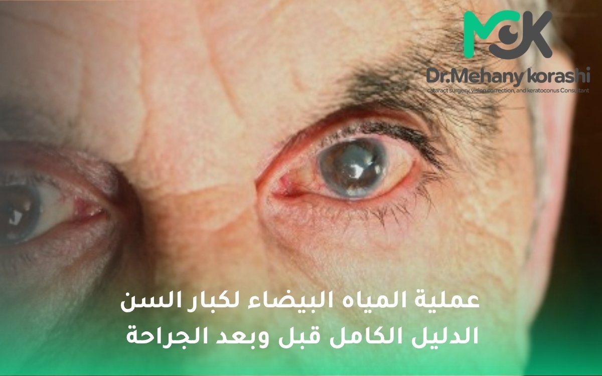 عملية المياه البيضاء لكبار السن
