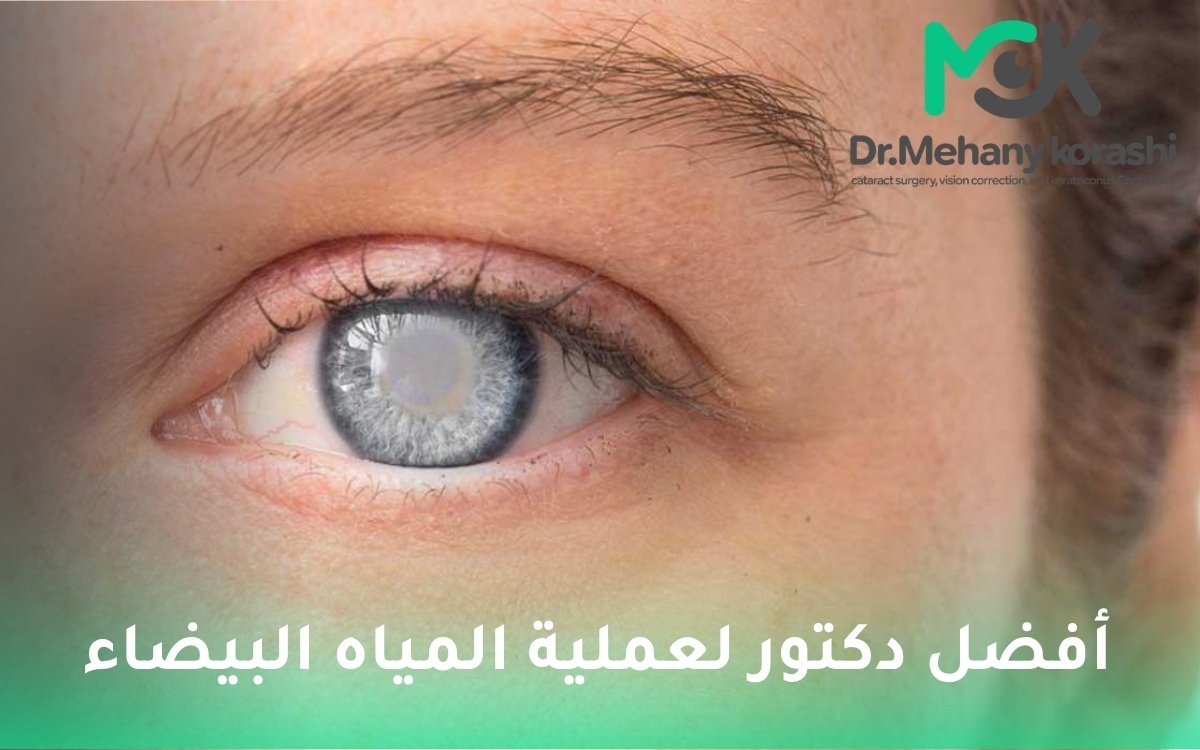 افضل دكتور لعملية المياه البيضاء