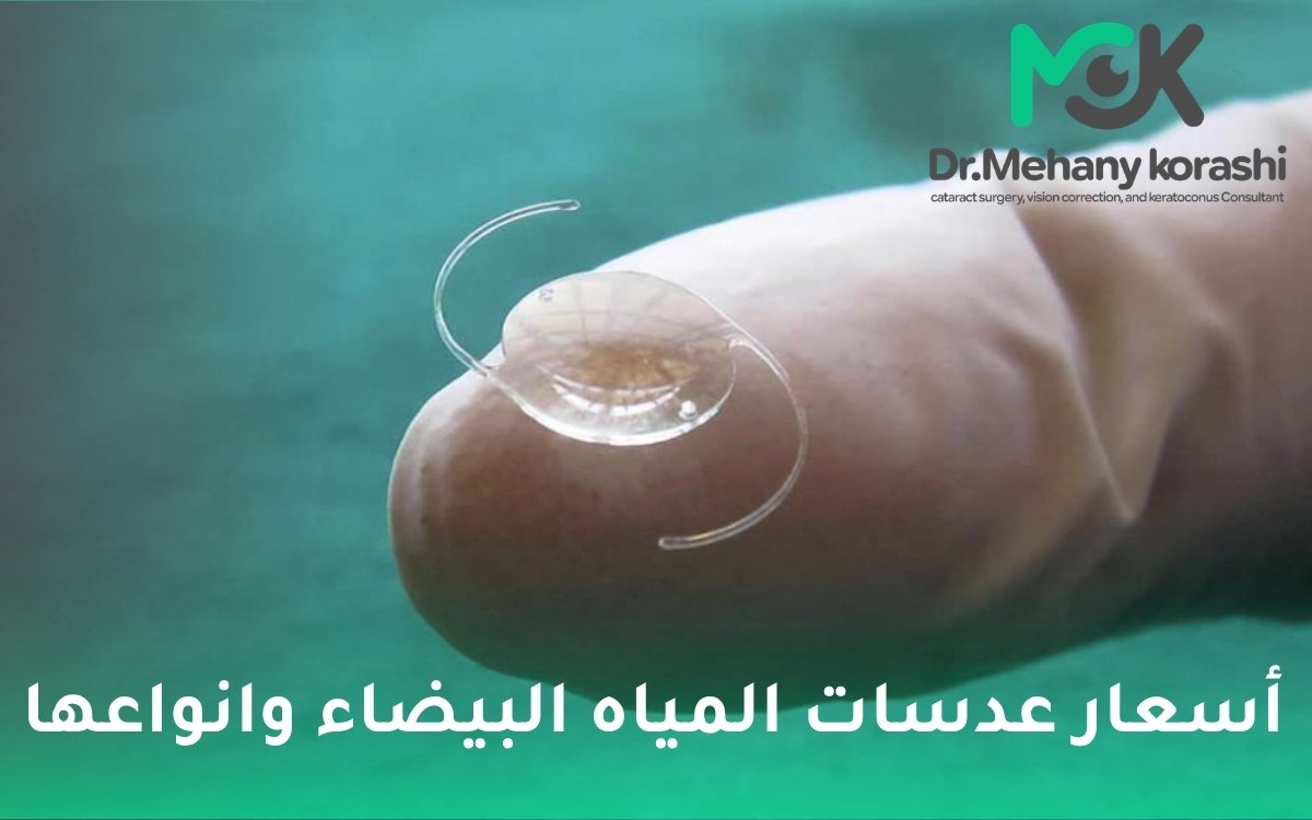 أسعار عدسات المياه البيضاء وانواعها