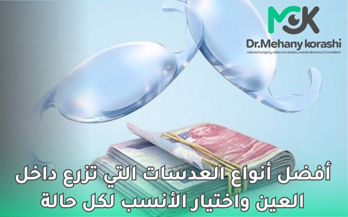 أفضل أنواع العدسات التي تزرع داخل العين