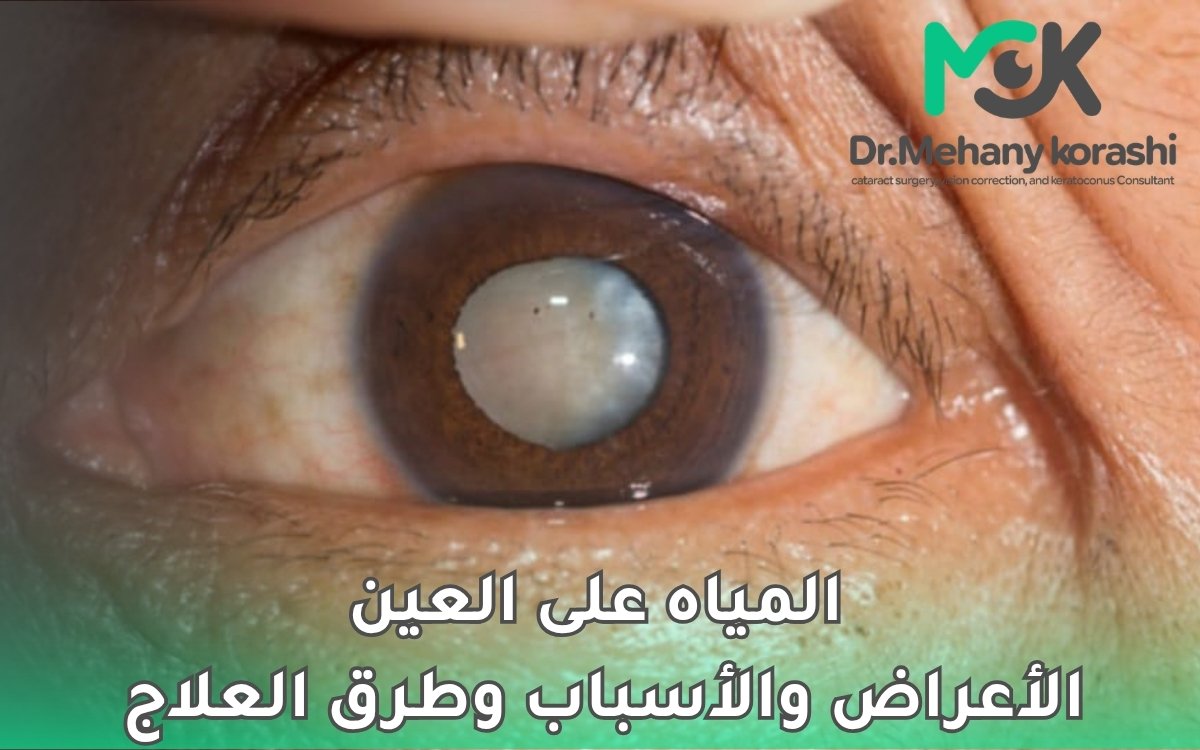 المياه على العين