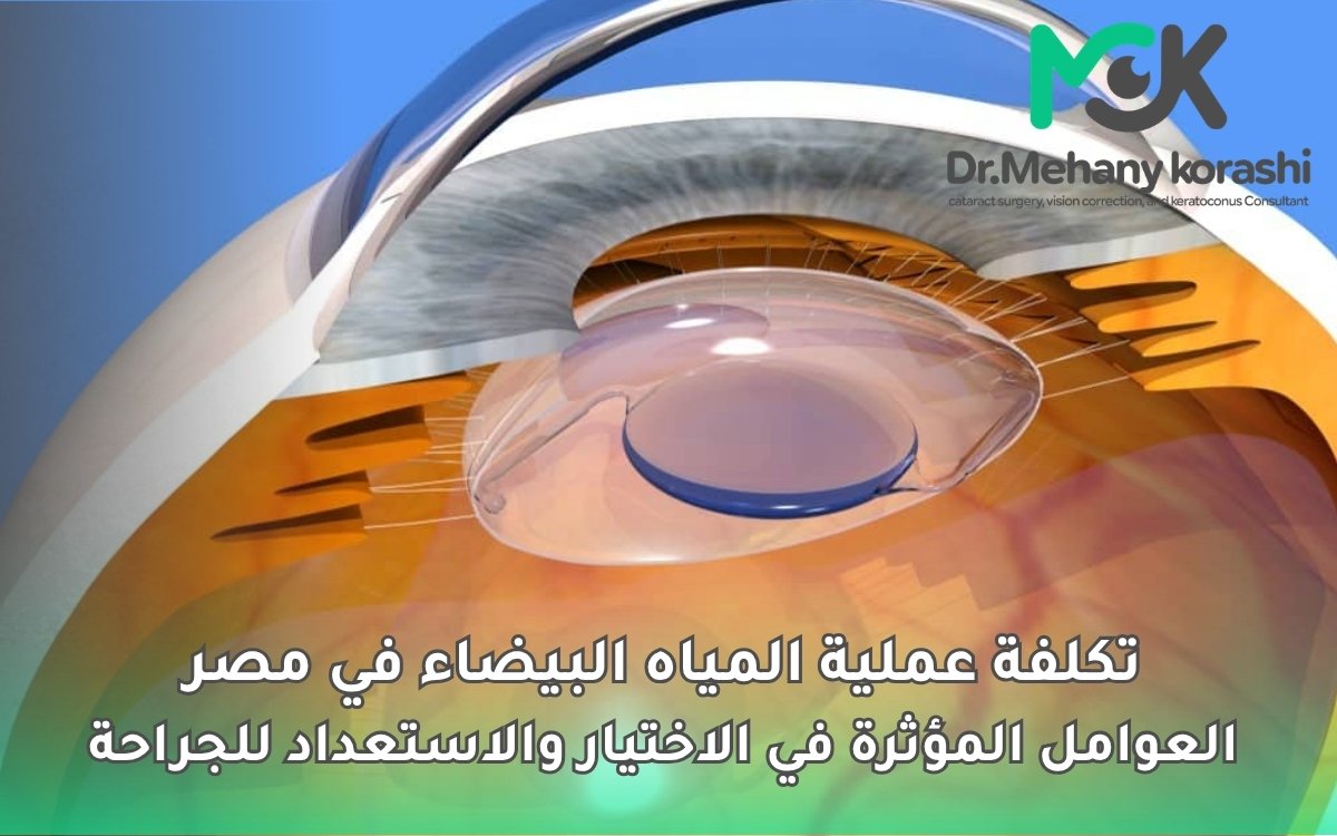 تكلفة عملية المياه البيضاء في مصر