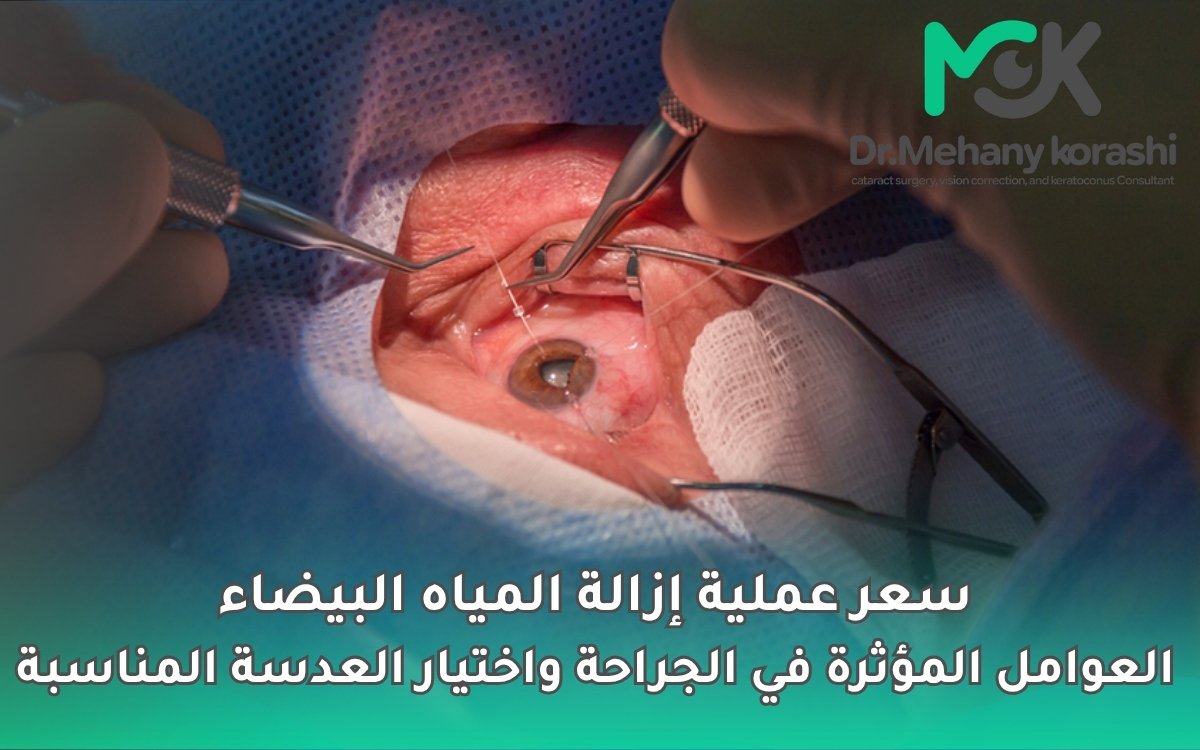 سعر عملية إزالة المياه البيضاء