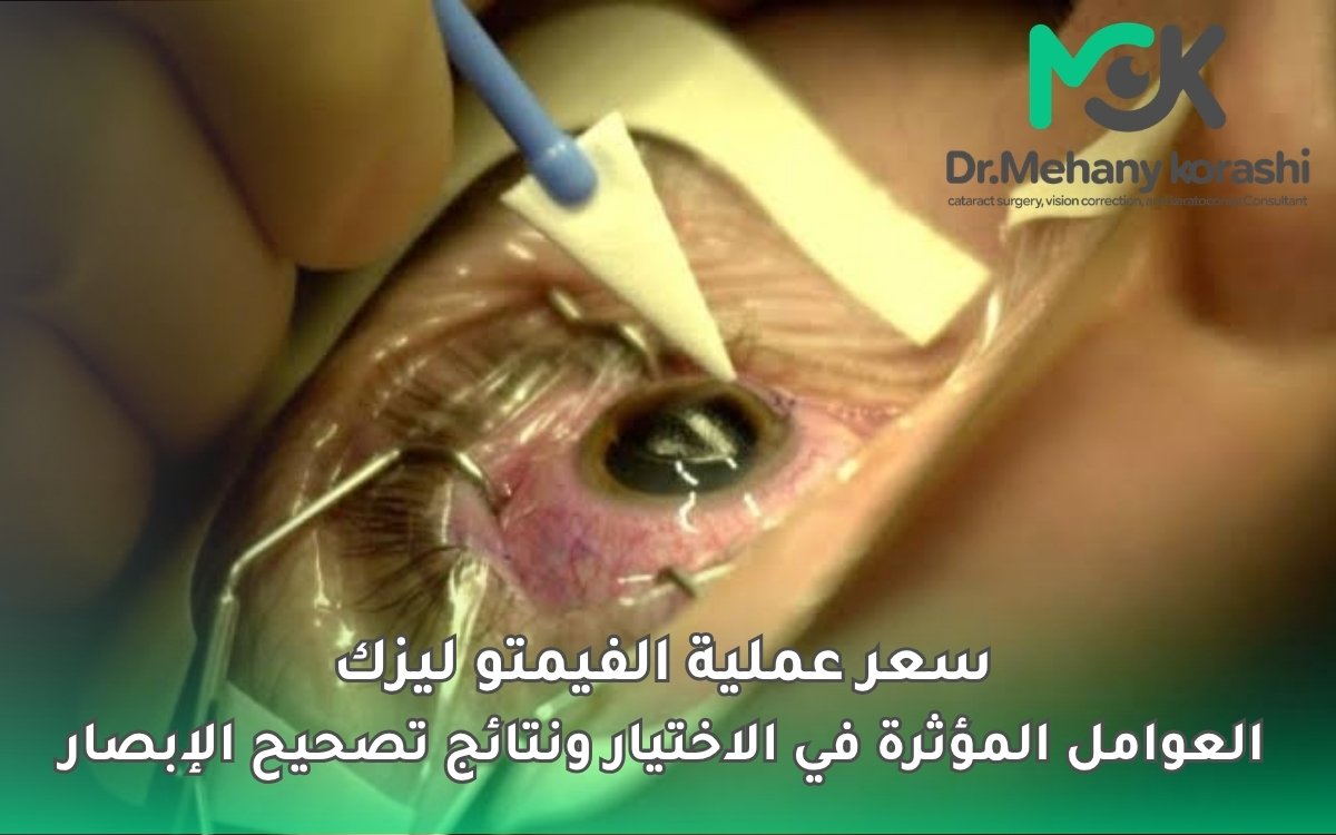 سعر عملية الفيمتو ليزك