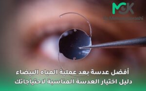 أفضل عدسة بعد عملية المياه البيضاء