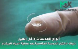 أنواع العدسات داخل العين