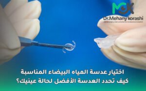 اختيار عدسة المياه البيضاء المناسبة